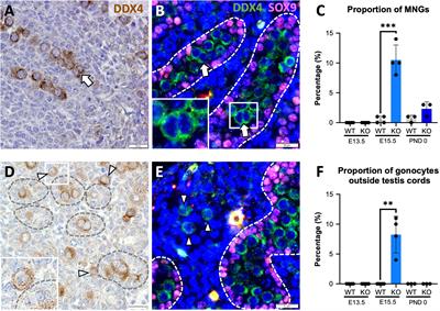 Testis exposure to unopposed/elevated activin A in utero affects somatic and germ cells and alters steroid levels mimicking phthalate exposure